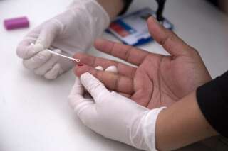 Covid-19: Le VIH augmente le risque de forme grave et de mortalité, confirme l'OMS