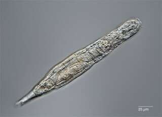 Un bdelloid rotifer ramené à la vie après avoir été gelé pendant 24000 ans en Sibérie.