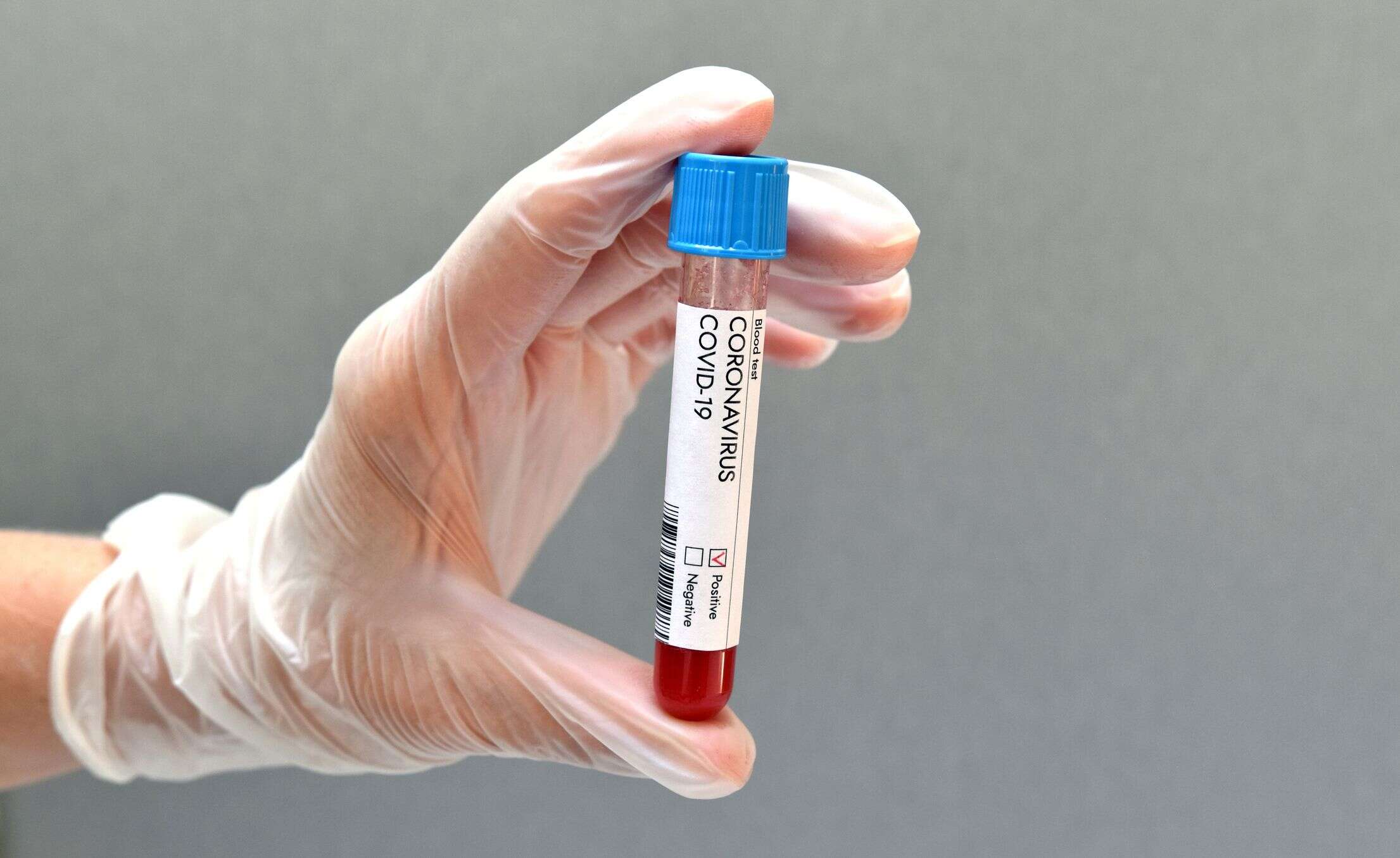 Les centres de vaccin anti-Covid auront des tests sérologiques en juin (photo d'illustration)