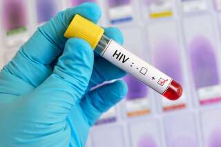 Un patient porteur du VIH serait en rémission sans greffe de moelle, les spécialistes appellent à la prudence
