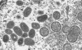 La variole du singe a été détectée dans plusieurs pays européens et américains au mois de mai 2022.