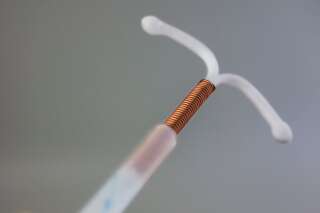 Le stérilet pourrait réduire de 30% les risques d'attraper un cancer du col de l'utérus