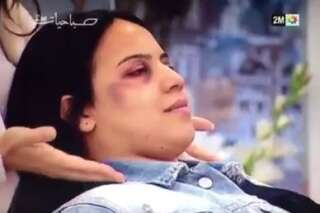 Polémique au Maroc après la diffusion à la télévision d'une démonstration de maquillage pour femmes battues