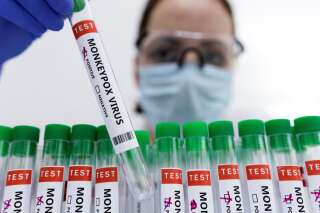 Cinq cas de variole du singe désormais recensés en France, l'OMS rassure