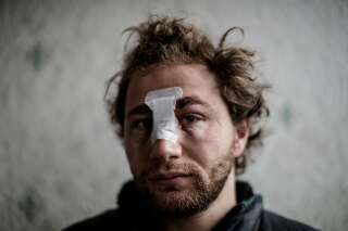 Photographe syrien blessé à Paris: le parquet ouvre une enquête