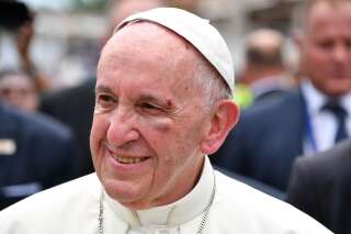 Le pape François se blesse en se cognant à sa Papamobile
