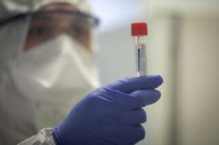 La France n'a pas les moyens de généraliser les tests de dépistage du coronavirus.