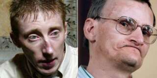 Patrick Dils (à gauche) a passé 15 ans en prison pour l'affaire dans laquelle Francis Heaulme (à droite) est de nouveau jugé.