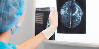 Une erreur dans le dépistage du cancer du sein aurait écourté entre 135 et 270 vies au Royaume-Uni
