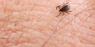 Les malades déçus du plan de lutte contre la maladie de Lyme