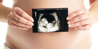 Detail Of Pregnant Woman Holding Ultrasound Scan