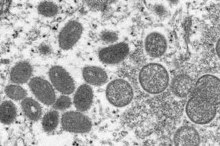 Que sait-on de la variole du singe dont de premiers cas ont été détectés en Europe