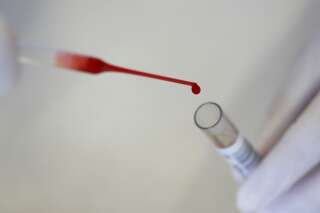 Ce nouveau test sanguin permettrait de détecter le cancer de manière précoce