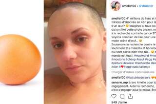 L'œuf d'Instagram lui inspire un défi pour aider la recherche contre le cancer