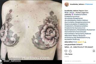 Ces tatoueurs font des prouesses pour transformer les cicatrices laissées par le cancer du sein