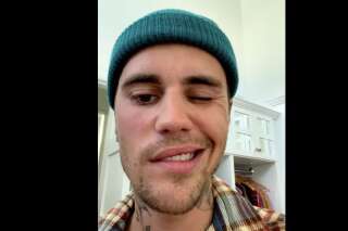 Justin Bieber annonce qu'un virus qui lui paralyse le visage et annule des dates de tournée