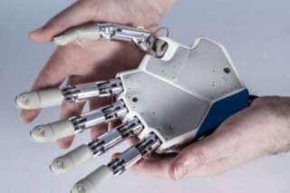 La première main bionique permettant de restaurer le toucher bientôt greffée