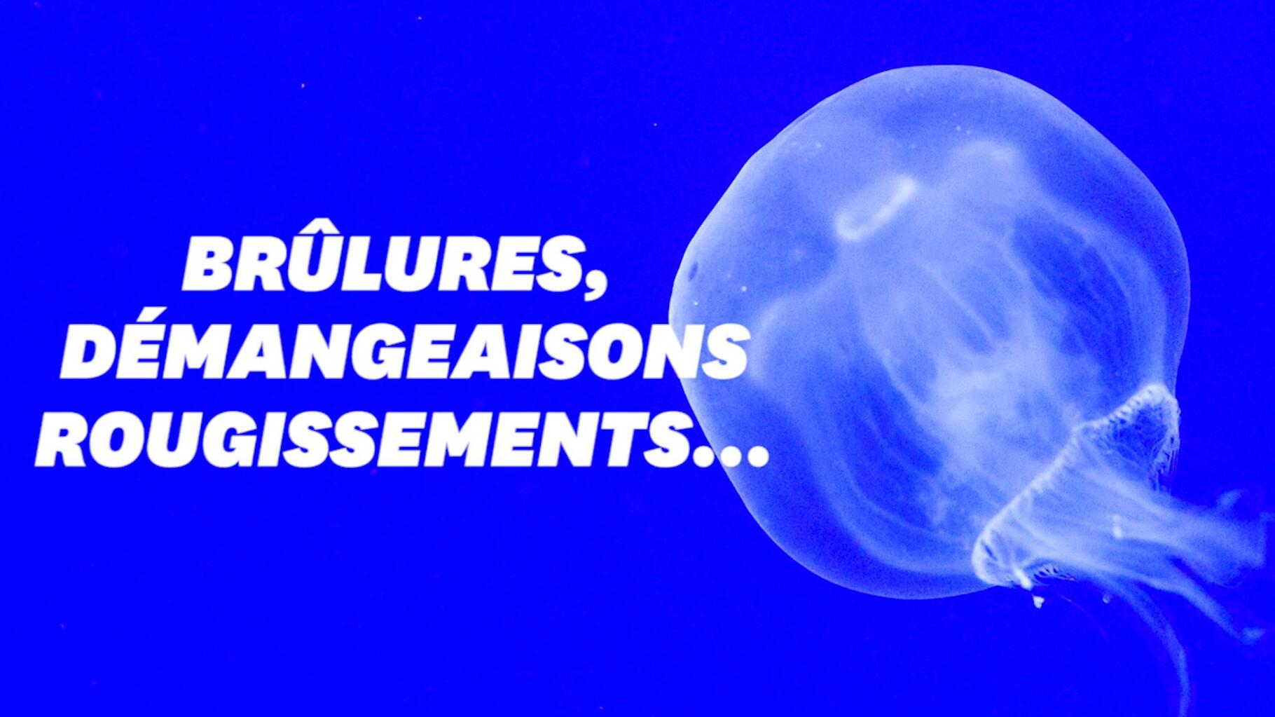 Vidéo : que faire en cas de piqûre de méduse ?