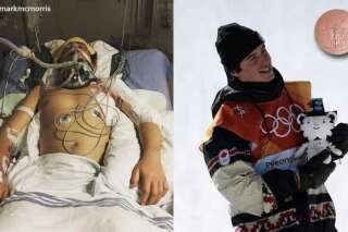 Jeux olympiques d'hiver 2018: ces deux photos d'un médaillé ont été prises à moins d'un an d'intervalle