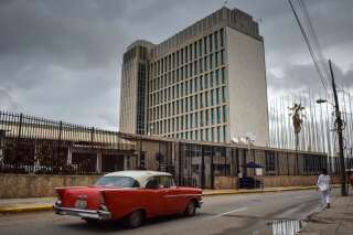 Le cerveau des diplomates américains de Cuba a bien 