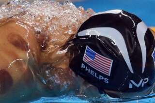 Ces taches rouges sur le corps de Michael Phelps sont les traces du 