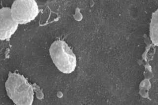 Une bactérie anti-obésité découverte par des chercheurs belges