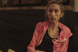 VIDÉO. L'actrice anorexique américaine Rachael Farrokh appelle les internautes à l'aide