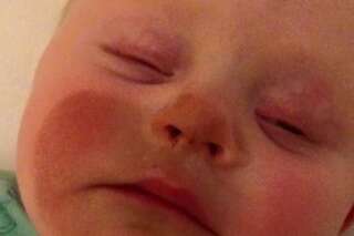 PHOTOS. Ce bébé, allaité par sa mère qui avait mis de l'autobronzant, se retrouve avec le visage orange