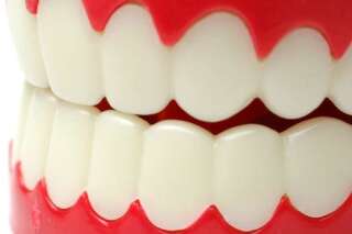Je grince des dents la nuit: le bruxisme pourrait être la cause de maux de têtes et de douleurs à la mâchoire