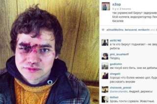 PHOTO. Ukraine: un journaliste photographié en sang après avoir été battu par la police