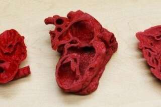 Une opération du cœur sur un bébé réussie grâce à l'impression 3D