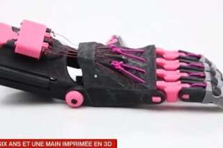 VIDÉO. Une prothèse de main imprimée en 3D remise à un enfant, une première en France