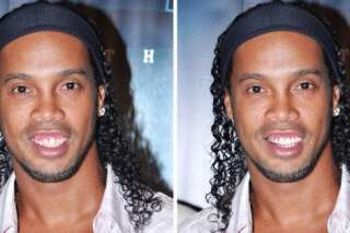 Les nouvelles dents de Ronaldinho: le joueur cède à la chirurgie esthétique