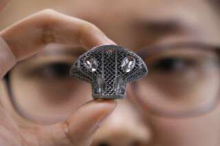 Innovation : contre le cancer des os, l'imprimante 3D permet des avancées dans la chirurgie orthopédique