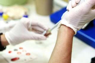Comment traiter l'infertilité des patients HIV positifs dans les centres IVI