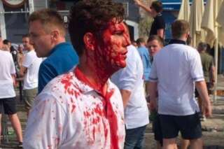 VIDÉO. La violence est montée d'un cran à Marseille entre supporteurs russes et anglais pour le match de l'Euro