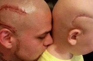 Ce papa se fait tatouer une cicatrice identique à celle de son fils, opéré du cerveau
