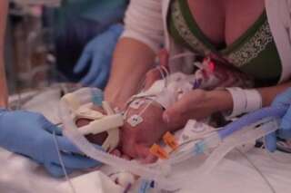 VIDÉO. La première année de vie d'un bébé prématuré de 700 grammes émeut le Web