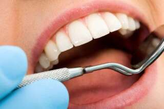 Mauvaise haleine, bouche sèche, dents usées... Huit choses que votre bouche révèle sur votre état de santé général