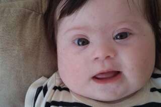 Louise, ma fille, quatre mois, deux bras, deux jambes et un chromosome en plus