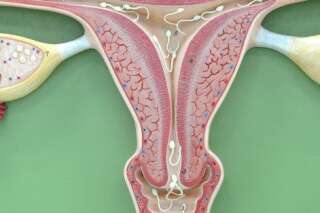 Cancer du col de l'utérus: vaccination et frottis pour mieux prévenir