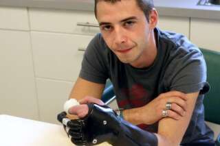 Doigts artificiels : la main bionique de Florian Lopes