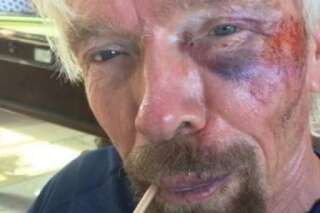 La miliardaire Richard Branson, fondateur de Virgin, victime d'un grave accident de vélo