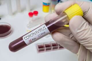 Coronavirus: le groupe sanguin est-il vraiment un indicateur de risque fiable?