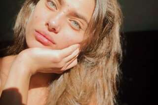 Taylor Hill, mannequin Victoria's Secret, fait l'unanimité pour son acné sur le front