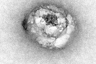Il aura fallu attendre 26 ans pour apercevoir le virus de l'hépatite C
