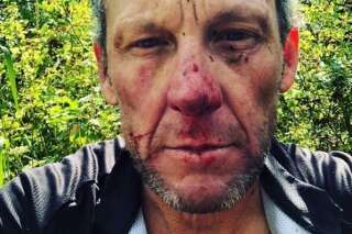 Lance Armstrong hospitalisé après un accident de vélo