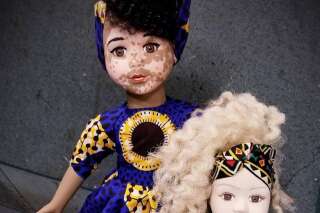 Vitiligo, albinisme: cette artiste créé des poupées pour toutes les beautés
