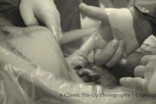 Un bébé saisit le doigt d'un chirurgien pendant une césarienne: la photo qui fait le buzz sur Internet