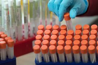 Coronavirus: les tests de dépistage au banc d'essai